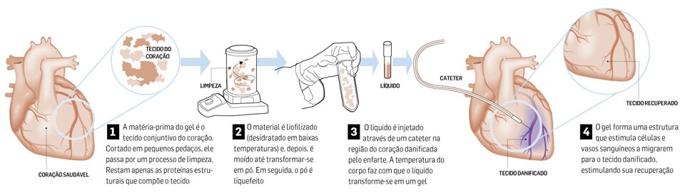http://infograficos.estadao.com.br/public/coracao/tecidocoracao.jpg